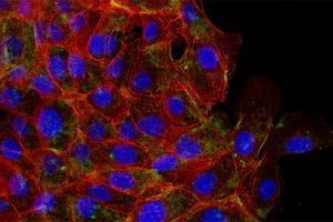Cells’ mechanical memory could hold clues to cancer metastasis