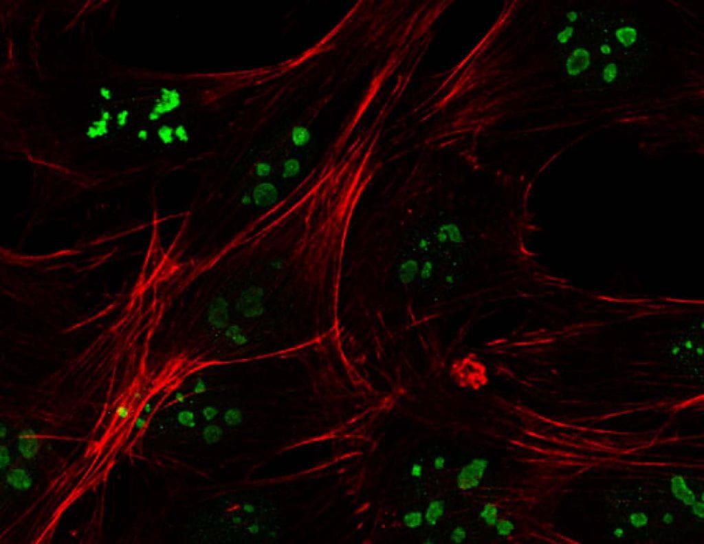 WashU researchers observe cancer-like nucleoli in healthy cells